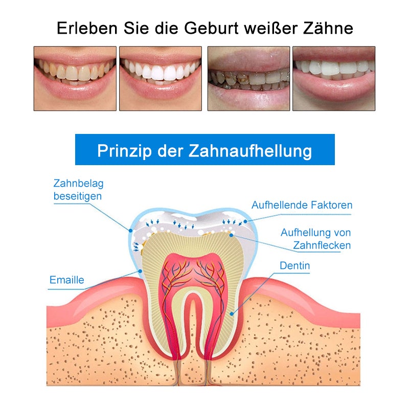 Zahnreinigungs- und Aufhellungsstift